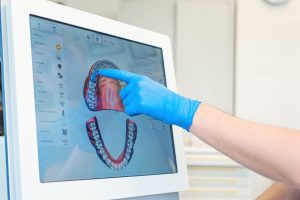 Scopri di più sull'articolo Scanner intraorale di ultima generazione: tecnologia e innovazione al servizio di dentista e paziente