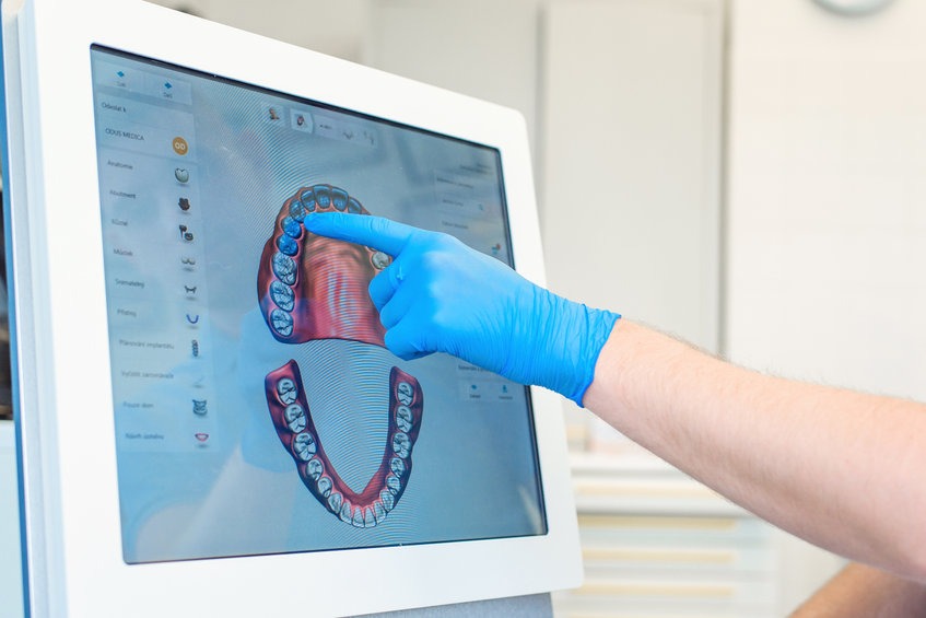 Al momento stai visualizzando Scanner intraorale di ultima generazione: tecnologia e innovazione al servizio di dentista e paziente